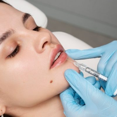 Enhance Your Natural Beauty with Lip Fillers: Subtle, Confidence-Boosting Results